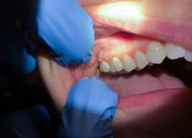Best Emergency Treatment for Toothache in Manhattan, KS